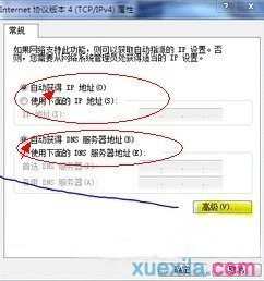 怎么解决win7系统本地连接没有有效的ip配置