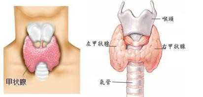 甲状腺瘤怎么形成的_甲状腺瘤形成的原因