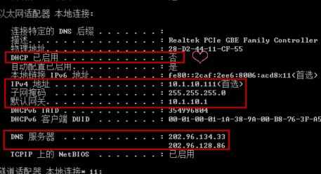 局域网设置dns的方法