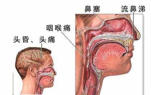 鼻炎的最佳治疗中药