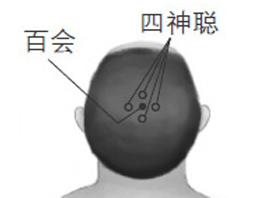 头晕怎么办